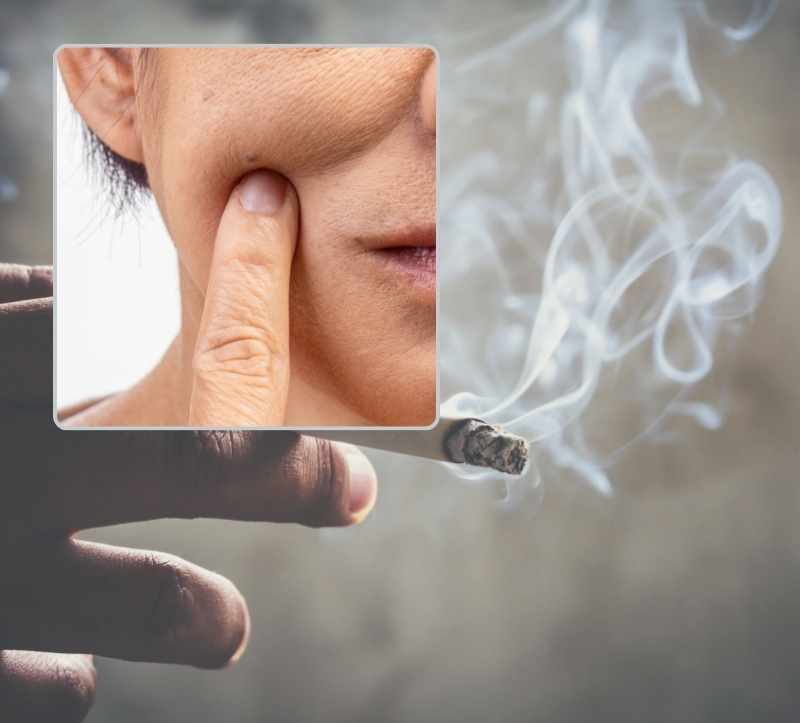 Warum Rauchen dich alt macht