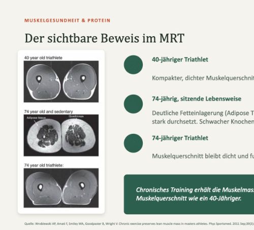Gesund älter werden: Muskelerhalt, Inflammaging und Immunkompetenz